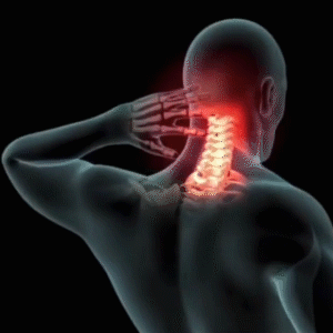 10 Parches para Dolor Cervical